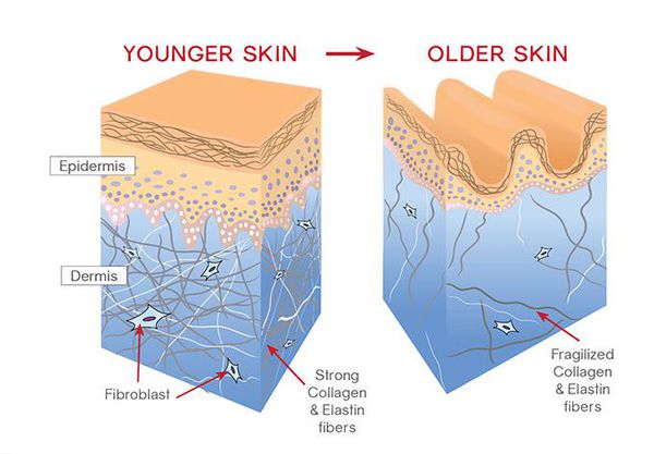 Признаки возрастных изменений кожи