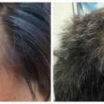 https://dgp1nn.ru/blog/wp-content/uploads/alopeciya-s.jpg