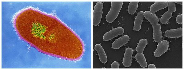 Бактерия Corynebacterium minutissimum