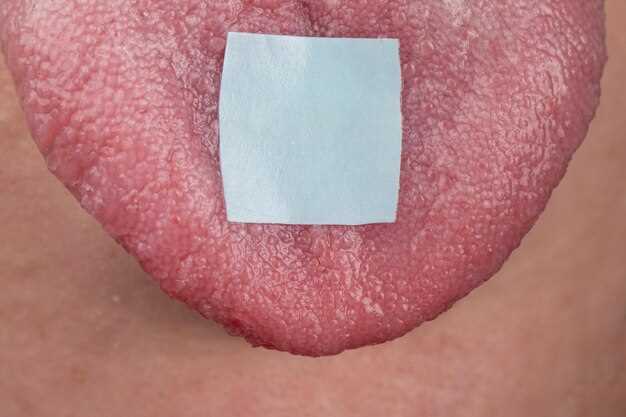 Причины белого налёта на половых губах