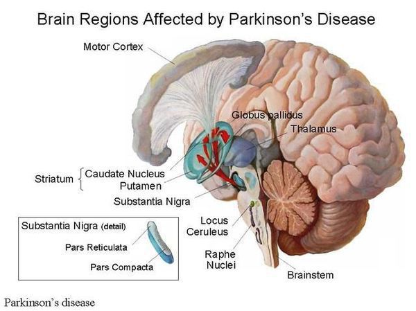 Области мозга, затронутые болезнью Паркинсона