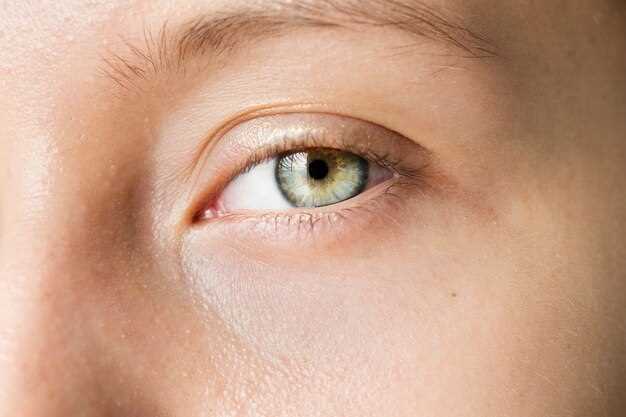 Лечение дегенерации желтого пятна сетчатки глаз