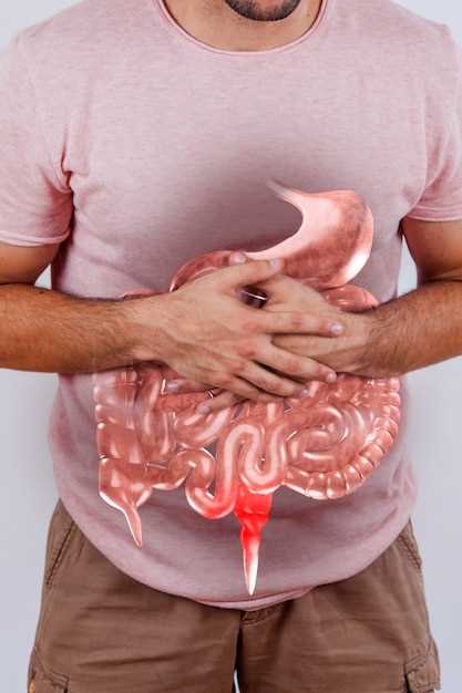Дивертикулез кишечника: причины, симптомы и методы лечения