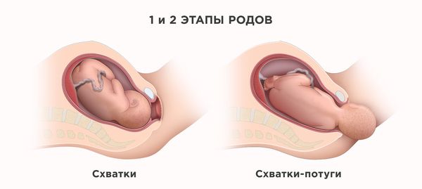 Этапы родов