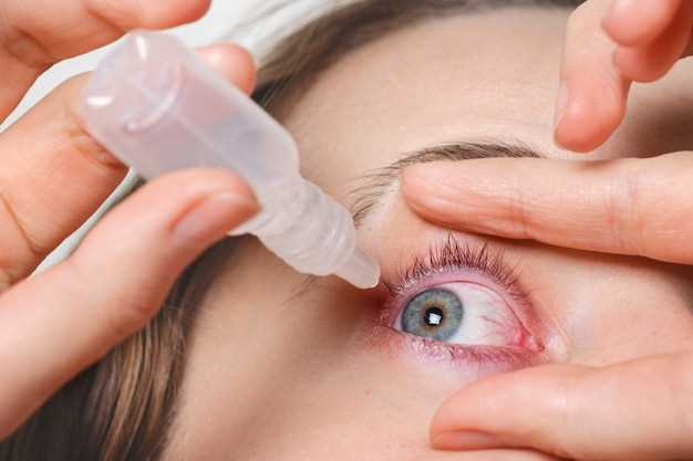 Список препаратов для лечения аллергии и воспаления глаз
