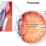 https://dgp1nn.ru/blog/wp-content/uploads/harakternye-narusheniya-pri-glaukome-s.jpg