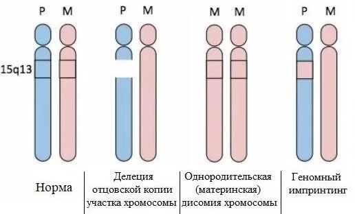 Хромосомные нарушения при СПВ