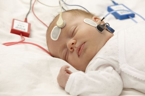 Измерение слуха у ребёнка во сне