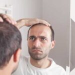 Как побриться налысо, уход и особенности лысой головы, сроки отрастания волос