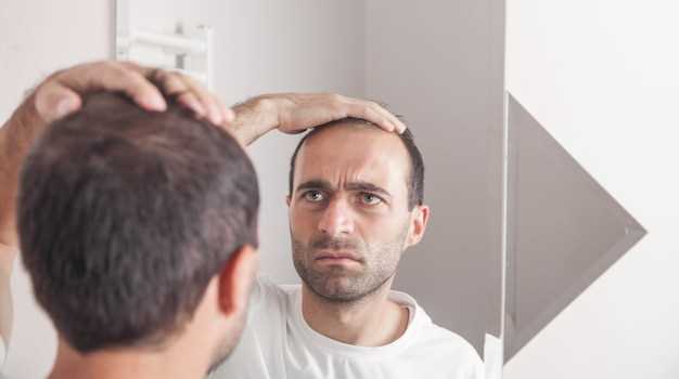 Как бриться налысо и ухаживать за лысой головой