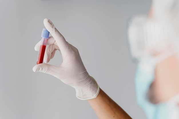 Подготовка к сдаче анализов на ВИЧ ПЦР