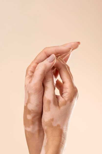 Симптомы трескания кожи под ногтями на руках