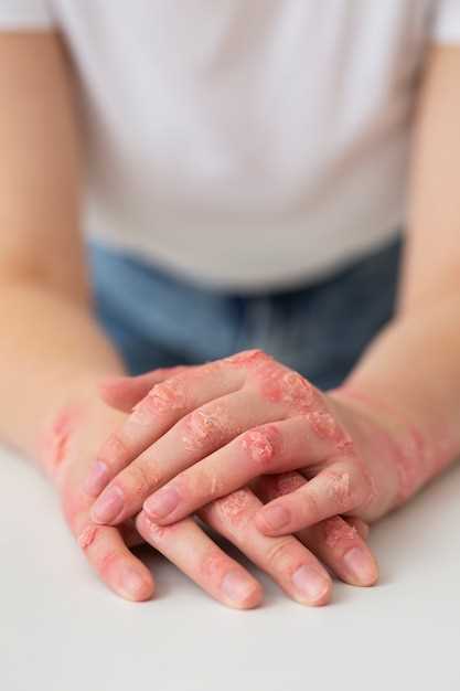 Аллергия и ее влияние на кожу