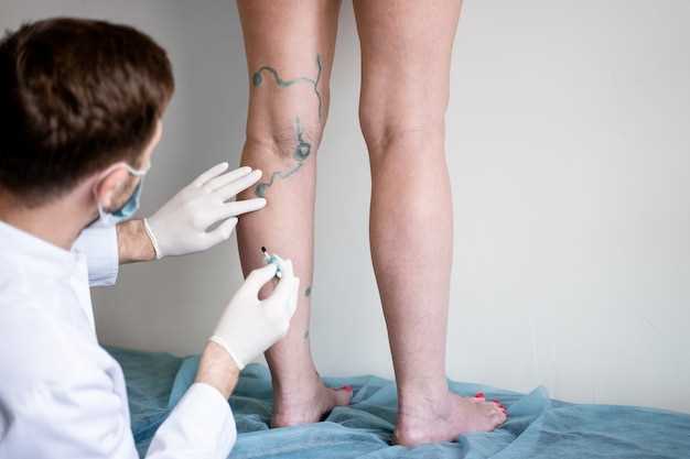 Лечение панариция на ноге без операции