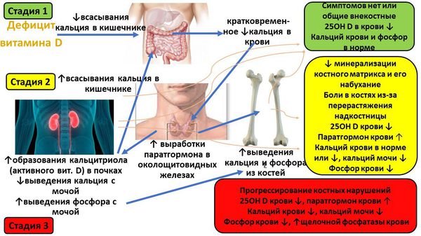 Механизм и этапы фoрмирования лабораторных изменений и костных нарушений при дефиците витамина D