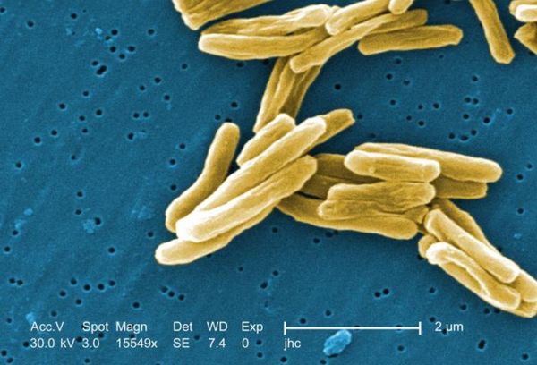 Микобактерия туберкулёза (палочка Коха) ' data-blur='False
