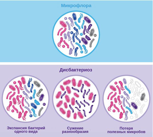 Микрофлора и типы дисбактериоза