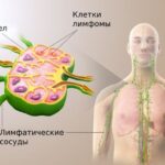 https://dgp1nn.ru/blog/wp-content/uploads/nehodzhkinskaya-limfoma-s.jpeg