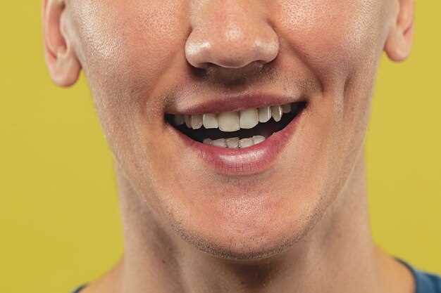 Причины некрасивого внешнего вида зубов