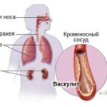 https://dgp1nn.ru/blog/wp-content/uploads/organy-misheni-pri-granulematoze-vegenera-s.jpg