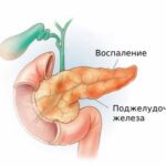 https://dgp1nn.ru/blog/wp-content/uploads/pankreatit-s-ztocotl.jpeg