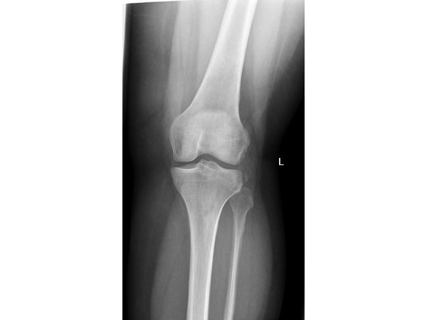 Рентген после травмы