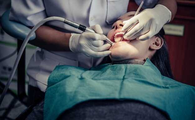 Лечение переломов челюсти