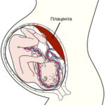 https://dgp1nn.ru/blog/wp-content/uploads/placenta-s-vyyicdj.jpeg