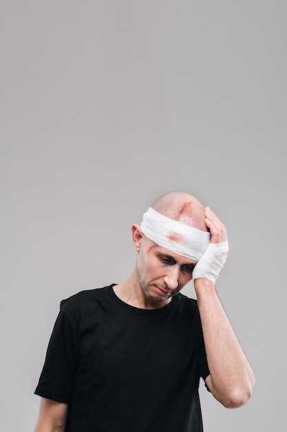 Причины боли в левой стороне головы после трепанации