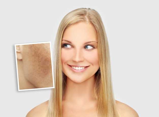 Важность питательных веществ для естественного восстановления кожи