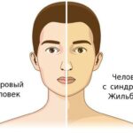https://dgp1nn.ru/blog/wp-content/uploads/sindrom-zhilbera-simptomy-i-lechenie_2.jpg