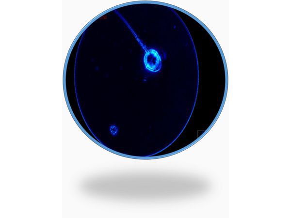 Метод NASUM (Native Assessment of Sperm Ultramorphology). Увеличение 20 000 крат. Видна внутренняя структура сперматозоида: хромосомы, хроматин, митохондрии, акросомальный аппарат и мембрана сперматозоида. 