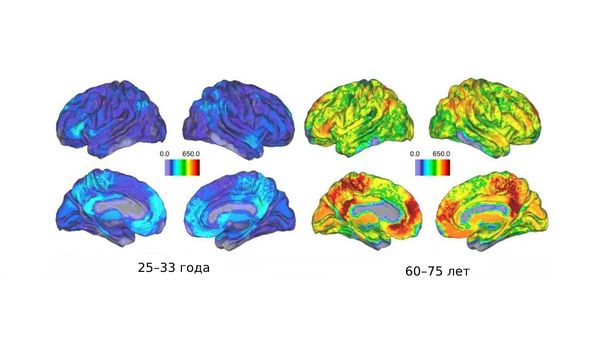 Снимки МРТ: активность мозга в течение жизни 