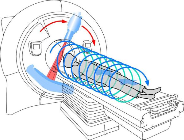 Спиральная компьютерная томография