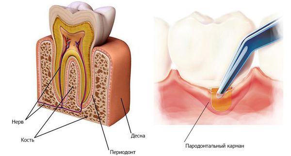 Строение зуба (периодонт и пародонтальный карман)