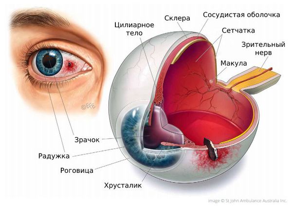 Травма глаза инородным предметом 