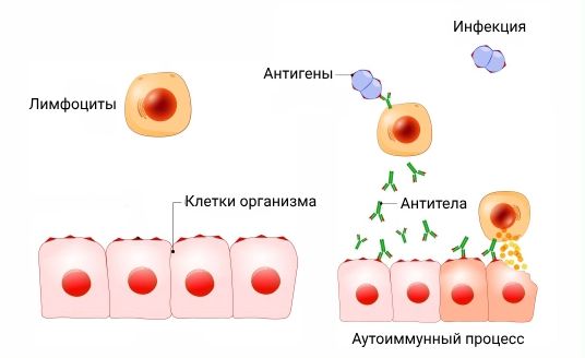 В-лимфоциты вырабатывают антитела против собственных тканей