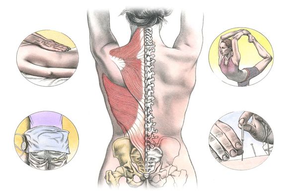Варианты лечения боли в спине