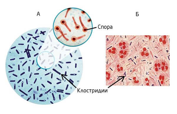 Вид клостридий при микроскопическом исследовании