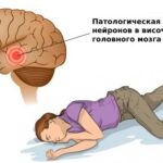 https://dgp1nn.ru/blog/wp-content/uploads/visochnaya-epilepsiya-s.jpeg