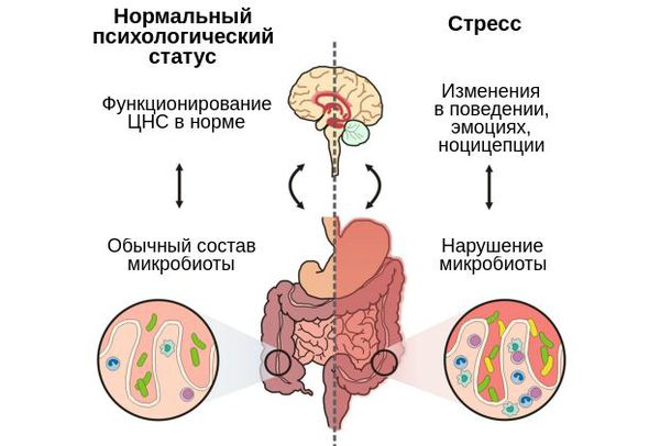 Влияние дисбиоза на нервную систему