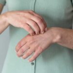Воспаление старого шрама: причины, симптомы и лечение