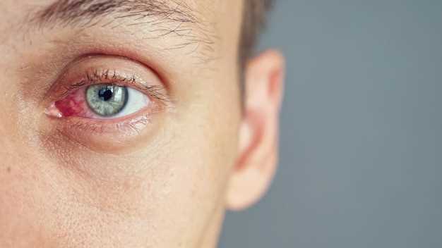 Симптомы воспалительных заболеваний глаз