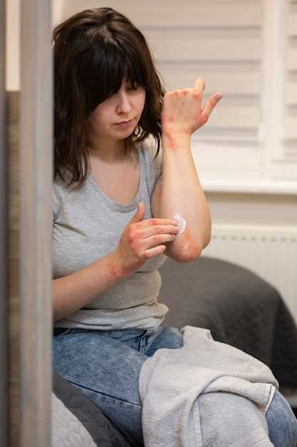 Способы домашнего лечения артрита пальцев рук