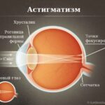 https://dgp1nn.ru/blog/wp-content/uploads/zdorovyy-glaz-i-astigmatizm-s.jpg
